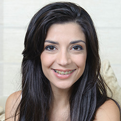 Woman with ceramic braces