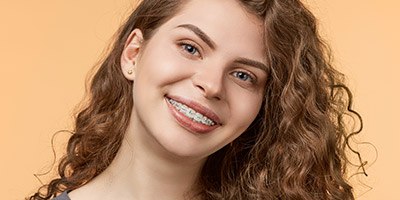 Woman with tooth-colored braces