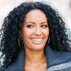 Woman with tooth-colored braces