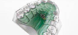 Orthodontic appliances