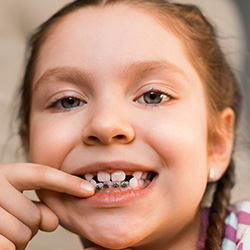 Young girl with orthodontic appliance