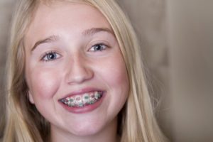 Girl smiling with braces.