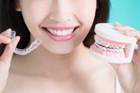 Woman holding braces and a clear tray in each hand