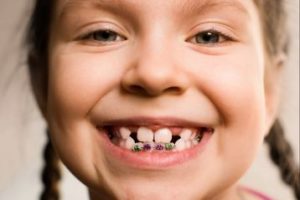 Smiling child in braces 